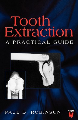 Tooth Extraction: A Practical Guide - Robinson, Paul D
