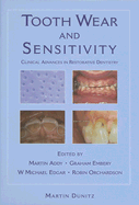 Tooth Wear and Sensitivity
