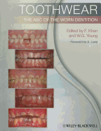 Toothwear: The ABC of the Worn Dentition