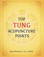 Top Tung Acupuncture Points