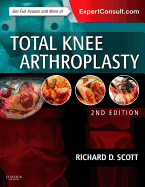 Total Knee Arthroplasty