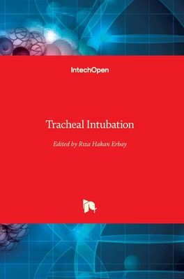Tracheal Intubation - Erbay, Riza Hakan (Editor)