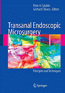 Transanal Endoscopic Microsurgery: Principles and Techniques