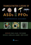 Transcatheter Closure of Asds and Pfos: A Comprehensive Assessment