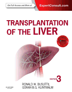 Transplantation of the liver