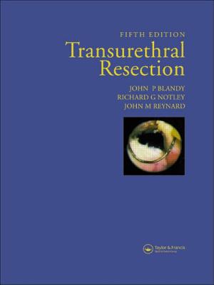 Transurethral Resection - Blandy, John P, and Notley, Richard