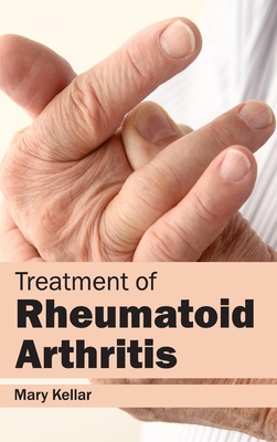 Treatment of Rheumatoid Arthritis - Kellar, Mary (Editor)