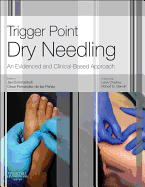 Trigger Point Dry Needling: An Evidence and Clinical-Based Approach