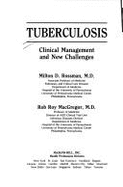 Tuberculosis: Clinical Management and New Challenges