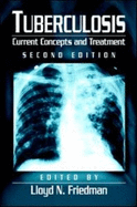 Tuberculosis: Current Concepts and Treatment, Second Edition - Friedman, Lloyd N (Editor)