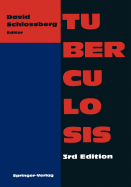 Tuberculosis