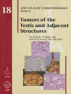 Tumors of the Testis and Adjacent Structures