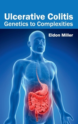 Ulcerative Colitis: Genetics to Complexities - Miller, Eldon (Editor)