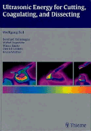 Ultrasonic Energy for Cutting, Coagulating, and Dissecting