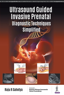 Ultrasound Guided Invasive Prenatal Diagnostic Techniques Simplified - Sahetya, Raju R