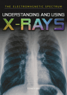 Understanding and Using X-Rays