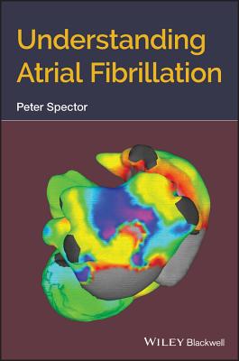 Understanding Atrial Fibrillation - Spector, Peter