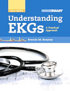 Understanding EKGs: A Practical Approach