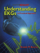Understanding EKGs: A Practical Approach