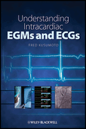 Understanding Intracardiac EGMs and ECGs