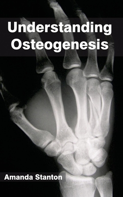 Understanding Osteogenesis - Stanton, Amanda (Editor)