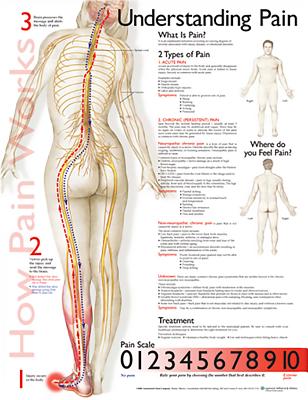 Understanding Pain Anatomical Chart - Anatomical Chart Company (Prepared for publication by)