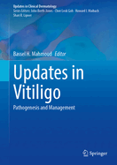 Updates in Vitiligo: Pathogenesis and Management