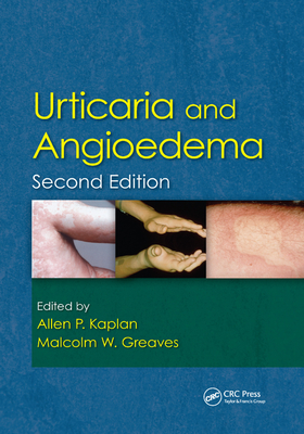 Urticaria and Angioedema - Kaplan, Allen (Editor), and Greaves, Malcolm W. (Editor)