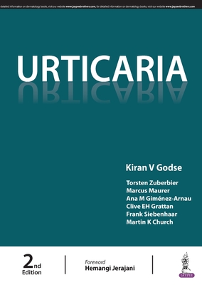 Urticaria - Godse, Kiran V (Editor)