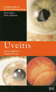 Uveitis - Lightman, Susan (Editor), and Towler, Hamish (Editor)