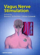 Vagus nerve stimulation