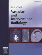 Vascular and Interventional Radiology