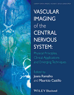 Vascular Imaging of the Central Nervous System: Physical Principles, Clinical Applications, and Emerging Techniques