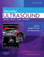 Vascular Ultrasound: How, Why and When