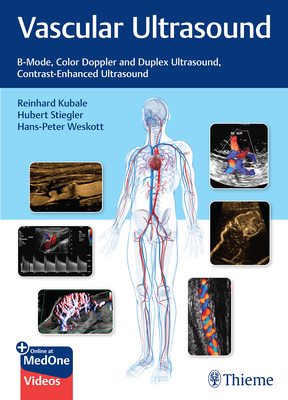 Vascular Ultrasound - Kubale, R