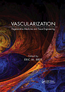 Vascularization: Regenerative Medicine and Tissue Engineering