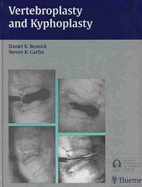 Vertebroplasty and Kyphoplasty