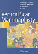 Vertical Scar Mammaplasty