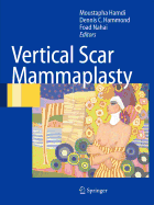 Vertical Scar Mammaplasty