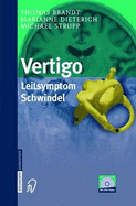 Vertigo: Leitsymptom Schwindel