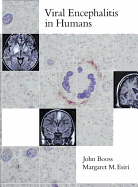 Viral Encephalitis in Humans