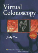 Virtual Colonoscopy