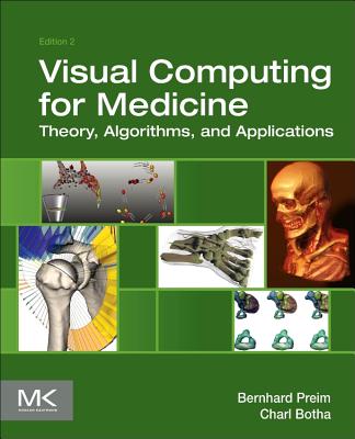 Visual Computing for Medicine: Theory, Algorithms, and Applications - Preim, Bernhard, and Botha, Charl P