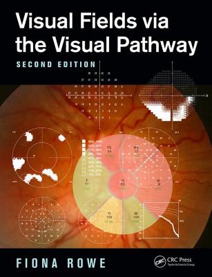 Visual Fields via the Visual Pathway - Rowe, Fiona