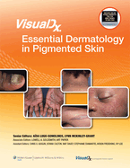Visualdx: Essential Dermatology in Pigmented Skin