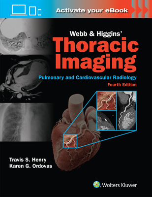 Webb & Higgins Thoracic Imaging: Print + eBook with Multimedia - Henry, Travis Scott, MD, and Ordovas, Karen Gomes, MD, Mas