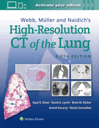 Webb, M�ller and Naidich's High-Resolution CT of the Lung