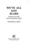 We've All Got Scars