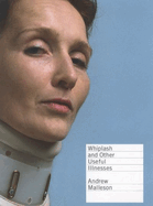 Whiplash and Other Useful Illnesses