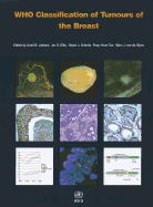 Who Classification of Tumours of the Breast [op]